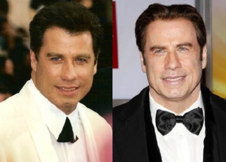 Before and After photos of John Travolta with opposite colored suits with bowties. Both smiling in black&white..