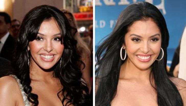 Vanessa Bryant's Plastic Surgery: Find All the Details Here